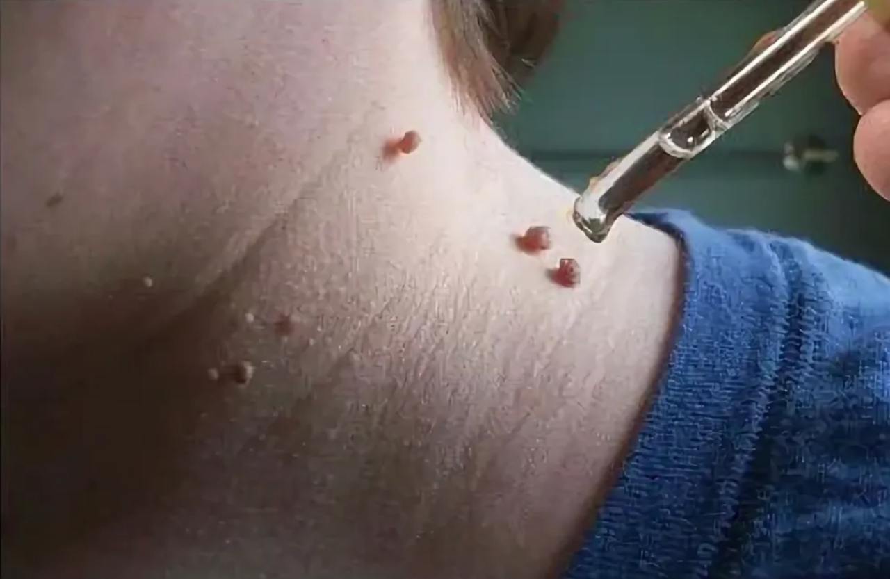 Benessere Digestivo